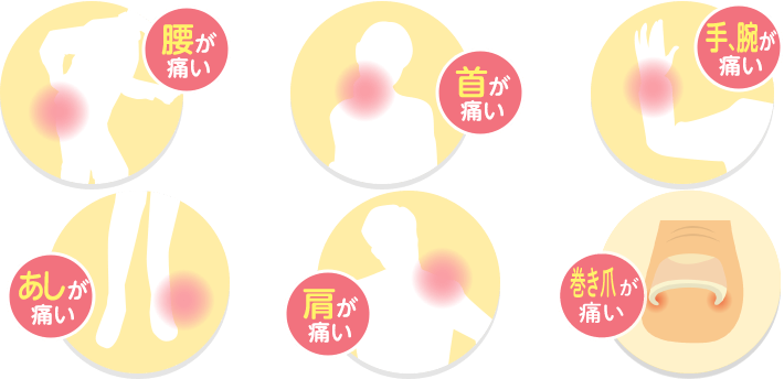 腰が痛い／首が痛い／手、腕が痛い／あしが痛い／肩が痛い